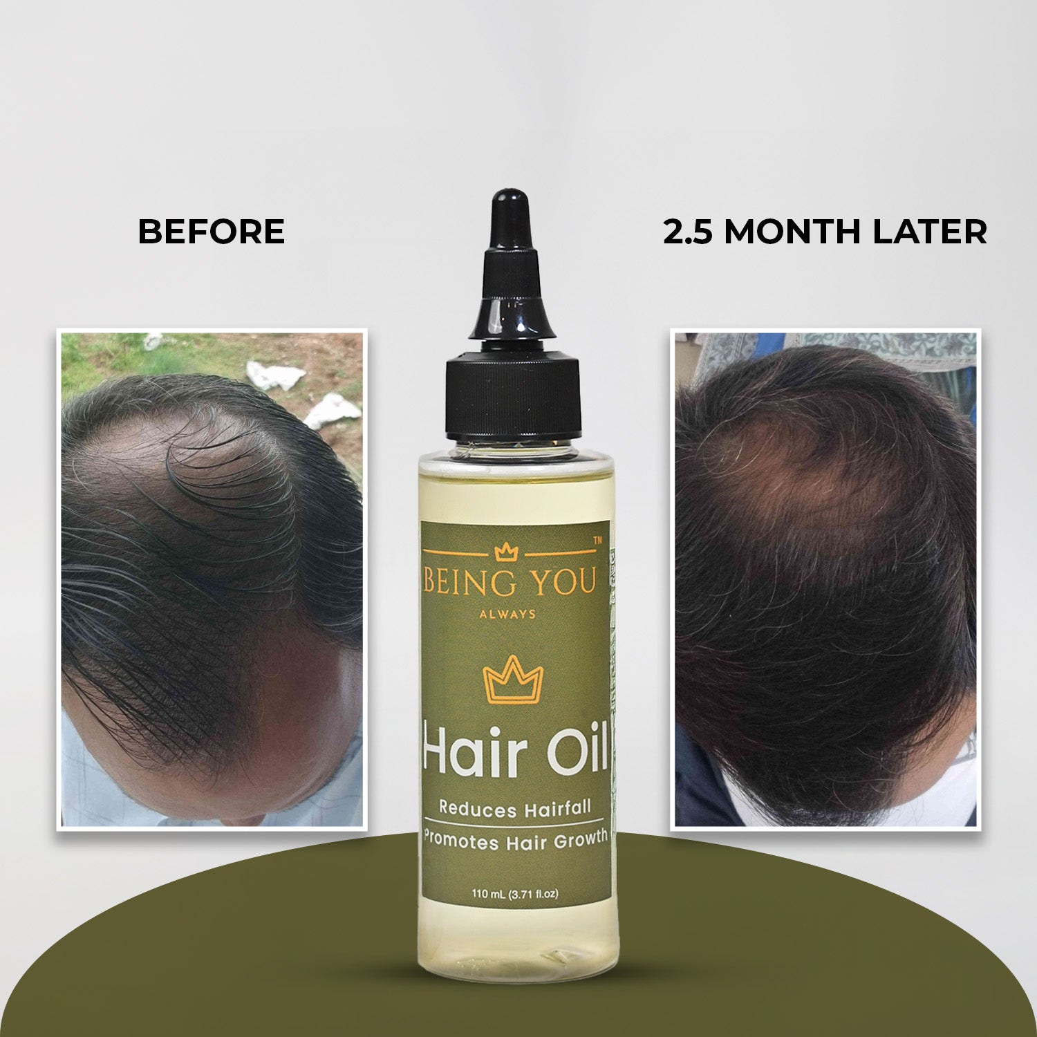 Hair Oil – Strengthens roots, reduces hair fall, and promotes growth